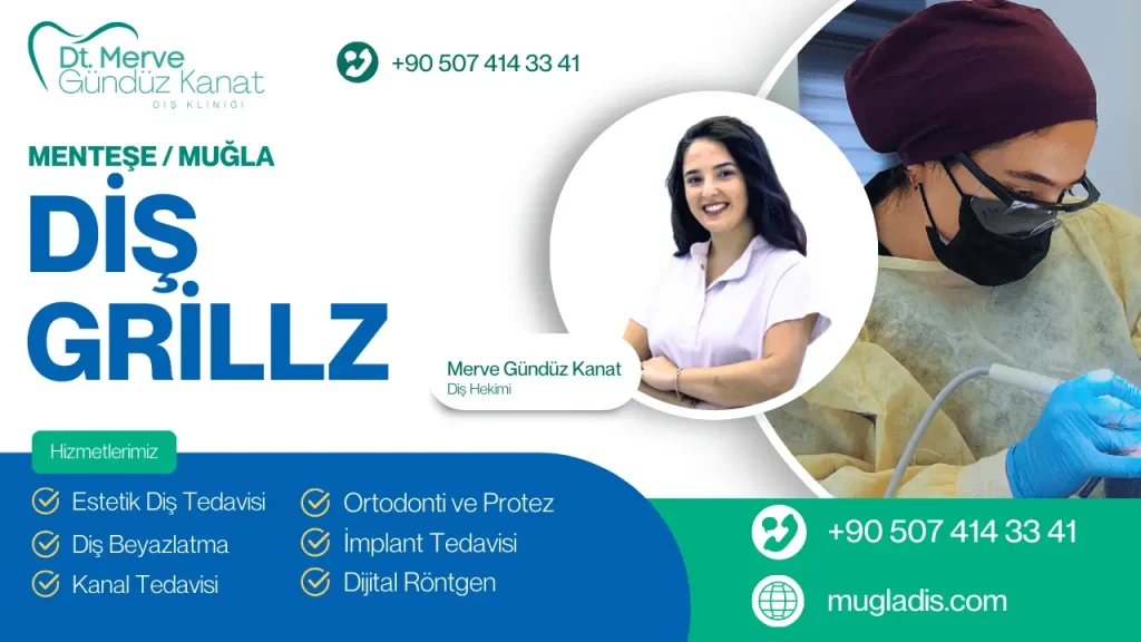 Modern grillz uygulaması - gümüş ve altın seçenekleriyle Muğla
