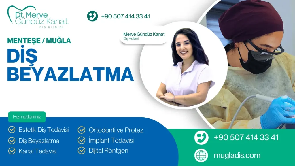 Muğla Menteşe diş beyazlatma işlemi sırasında kullanılan teknikler.