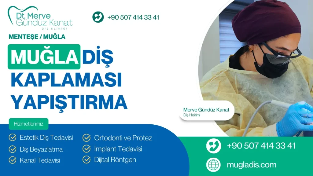 Düşen diş kaplaması yapıştırma hizmeti Muğla Diş Kliniği