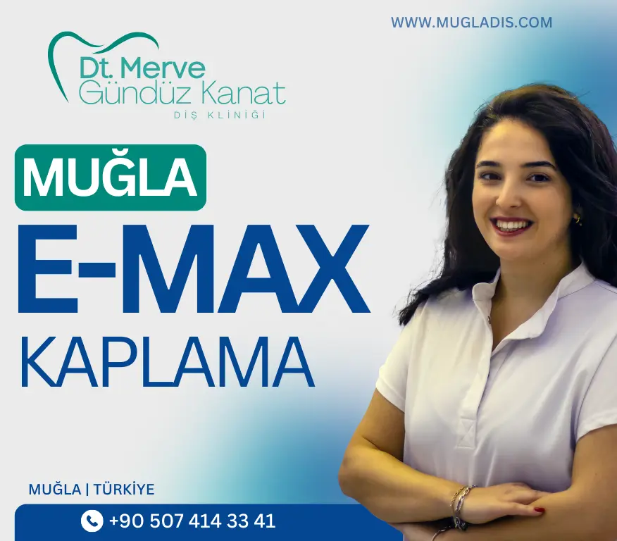Muğla’da e-max kaplama tedavisi için diş kliniğinde doğal gülüş tasarımı yaptıran hasta